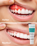 Parodontose-Gel 3er Pack (30ml) – Intensive Zahnfleischpflege | BeoVita